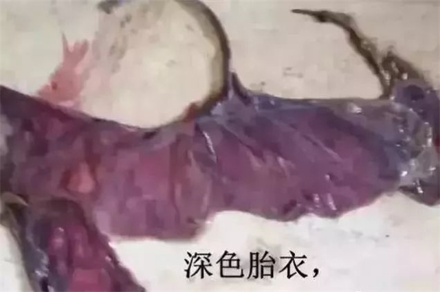 �ж�ĸ���Ƿ�����4������̥����ɫ